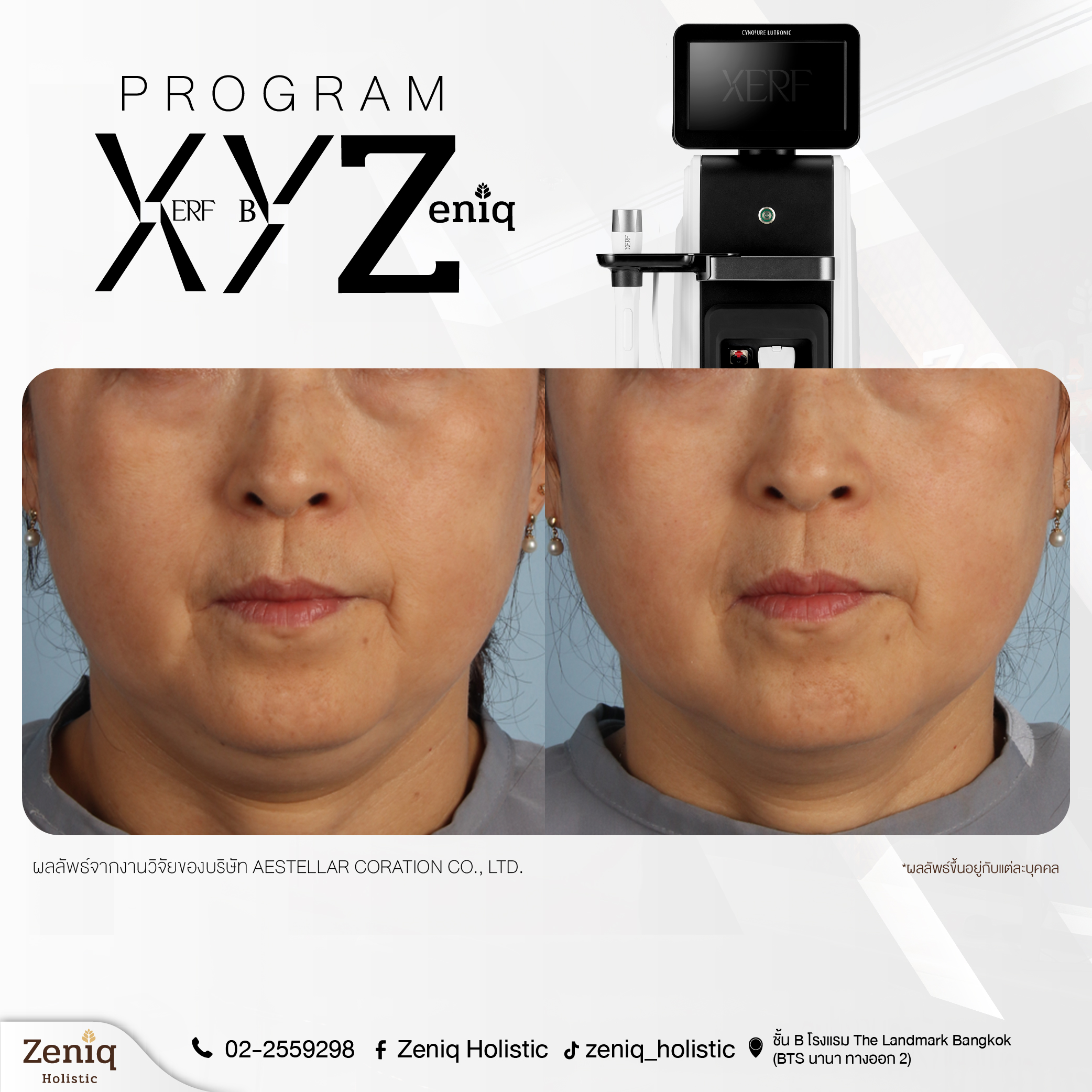 reviewxerf2